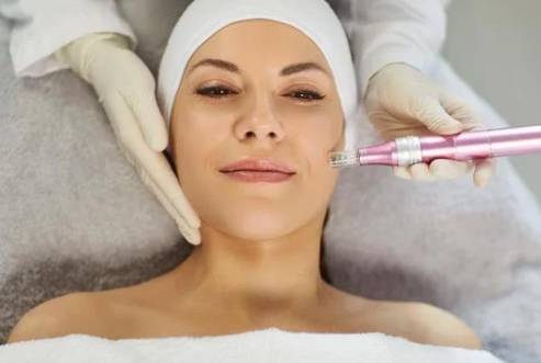 microneedling treatment at rumi in chino california