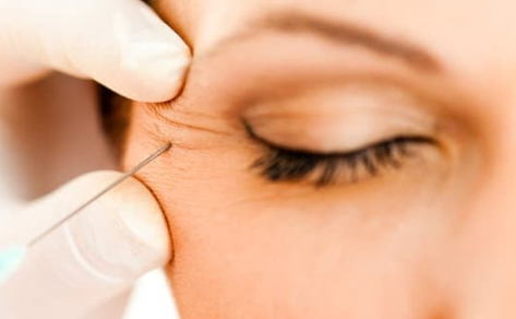 Women getting Daxxify injection around her eye for crows feet at Rumi in Chino California