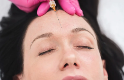women getting injection of PRF in forehead at Rumi med spa in Chino California